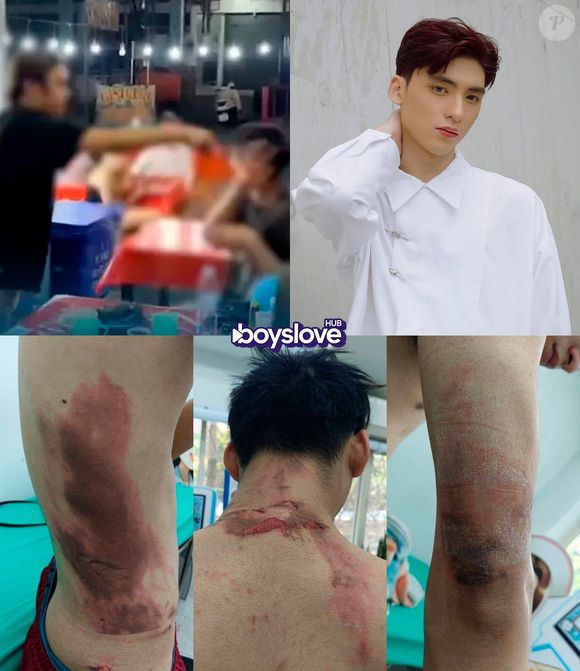 Vingança, sopa fervente e cabelo cortado: Mister Teen Global é vítima de violência brutal na Tailândia e situação vira caso de polícia