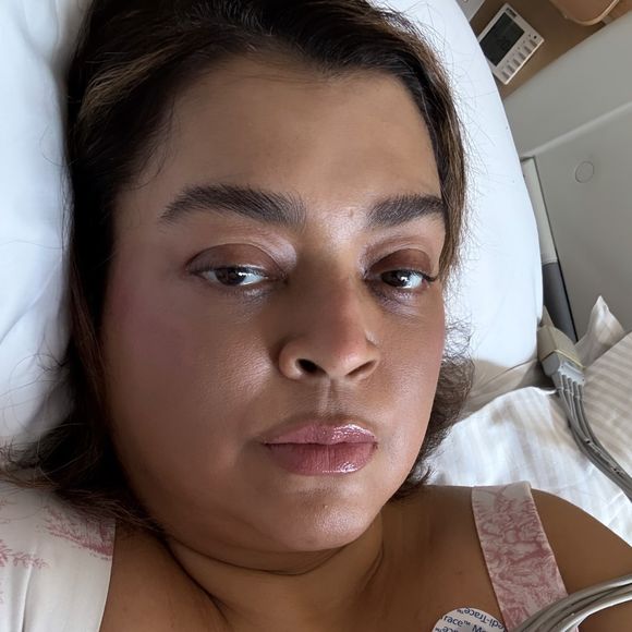 Preta Gil retirou tumores na cirurgia