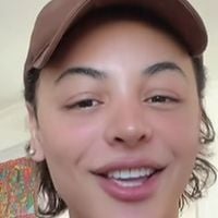 ‘Nem parece’: Pabllo Vittar exibe resultado de terceira rinoplastia e levanta debate; entenda