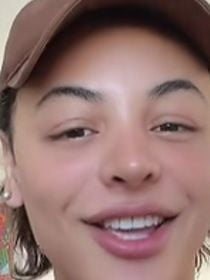 ‘Nem parece’: Pabllo Vittar exibe resultado de terceira rinoplastia e levanta debate; entenda