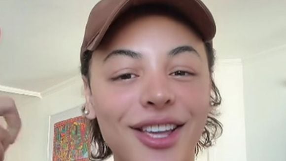 ‘Nem parece’: Pabllo Vittar exibe resultado de terceira rinoplastia e levanta debate; entenda