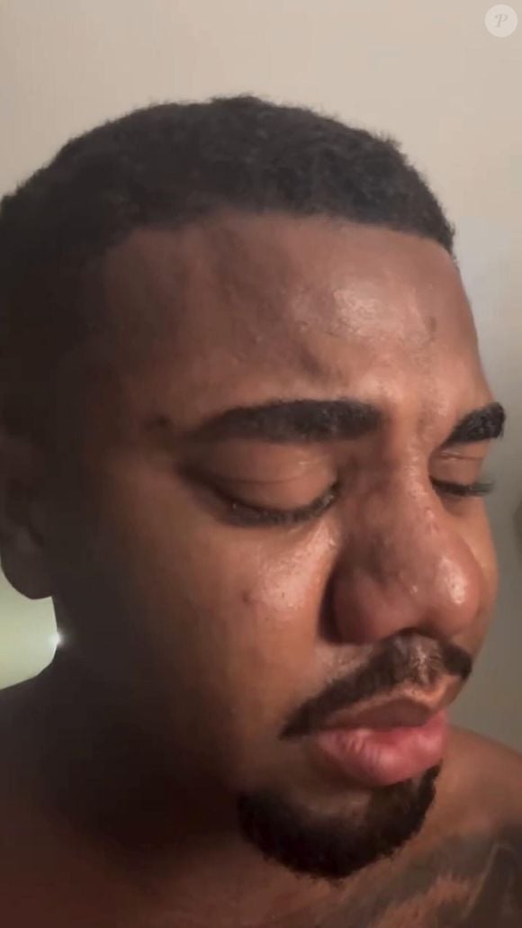 Davi assumiu que errou com a ex e contou que Adriana Paula resolveu encerrar a relação por não ter gostado da exposição