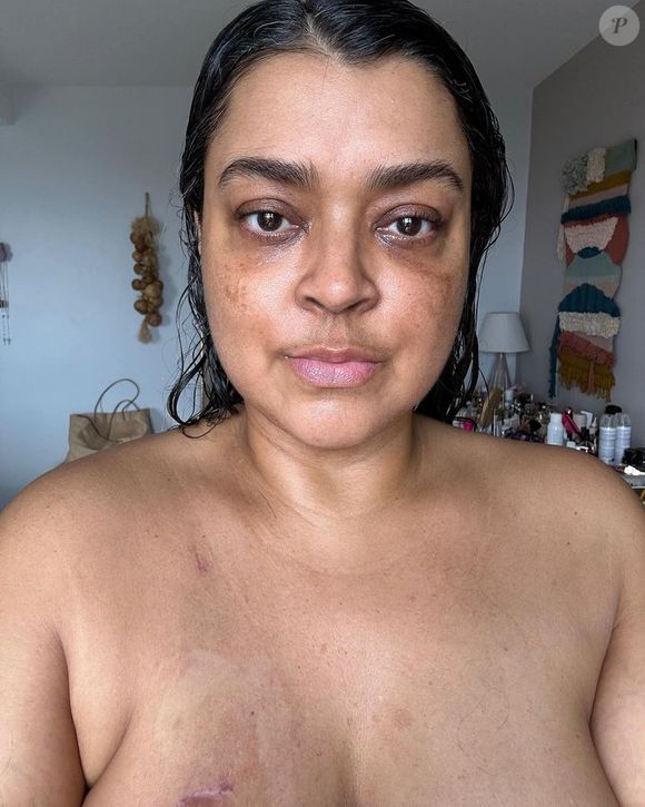 Segundo a colunista Fábia Oliveira, o estado de saúde de Preta Gil piorou muito na última semana