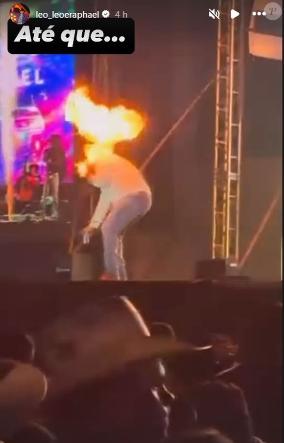 Léo cantava no interior de SP quando foi atingido pelas chamas de uma máquina de efeitos especiais