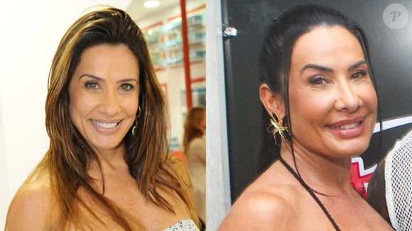 Nos últimos anos, Scheila Carvalho mudou sua aparência com a harmonização facial, mas se arrependeu e desfez parte do procedimento