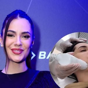 Esposa de Luan Santana, Jade Magalhães recorre a procedimento inovador para 'colocar a pele no lugar'; médica explica técnica de lifting imediato