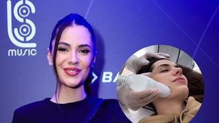Nem harmonização, nem preenchimento: Jade Magalhães recorre a procedimento de 'lifting imediato' para 'colocar a pele no lugar'; médica explica técnica