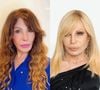 Antes e depois das famosas que apostaram em procedimentos para rejuvenescer: Elba Ramalho, Kris Jenner e mais!
