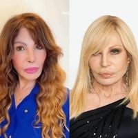 Muito além de Elba Ramalho: estas famosas rejuvenesceram décadas com procedimentos estéticos e antes e depois é de cair o queixo