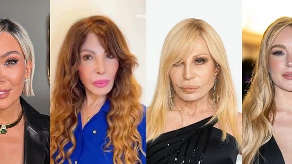 Muito além de Elba Ramalho: estas famosas rejuvenesceram décadas com procedimentos estéticos e antes e depois é de cair o queixo