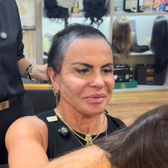 Gretchen tem inspirado outras mulheres ao expor publicamente sua luta com a alopecia