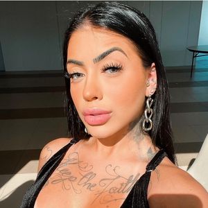 Procedimentos estéticos deram um novo rosto para MC Mirella