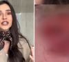 Gizelly Bicalho revela silicone malsucedido e exibe imagem chocante do resultado estético nas redes sociais
