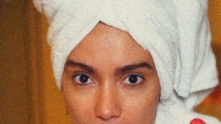 Anitta fez transplante de sobrancelhas? Procedimento no rosto vira febre entre famosas que buscam valorizar olhar e médicos explicam: 'Transformação visível no mesmo dia'