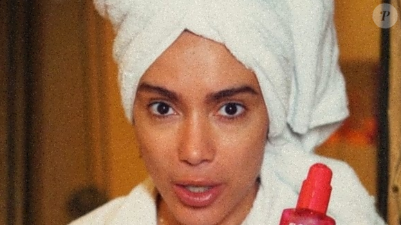 Anitta fez transplante de sobrancelhas? Procedimento no rosto vira febre entre famosas que buscam valorizar olhar e médicos explicam: 'Transformação visível no mesmo dia'