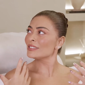 Juliana Paes revelou que o que mais amou no procedimento foi o fato da pele se manter elástica e não mudar sua fisionomia, como os tradicionais preenchedores