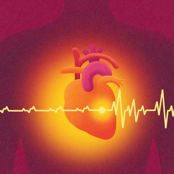 ‘A fibrilação atrial, como o próprio nome diz, representa uma alteração específica dos átrios do coração’, resume o Dr. Edmo Atique Gabriel. Confira na matéria!