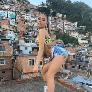 Então, MC Mirella recorreu aos preenchedores estratégicos em seu rosto