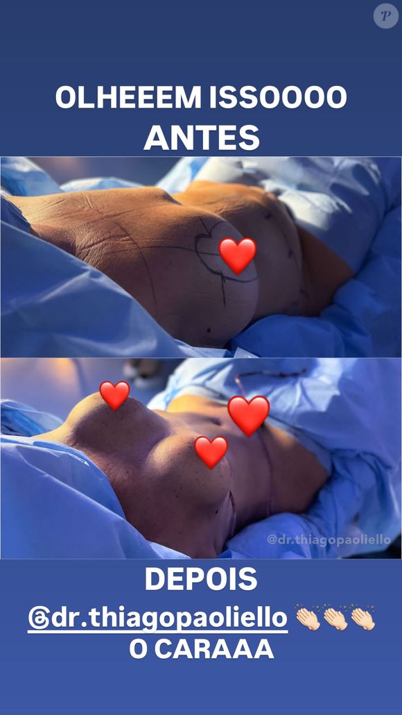 Margareth Serrão colocou silicone nos seios