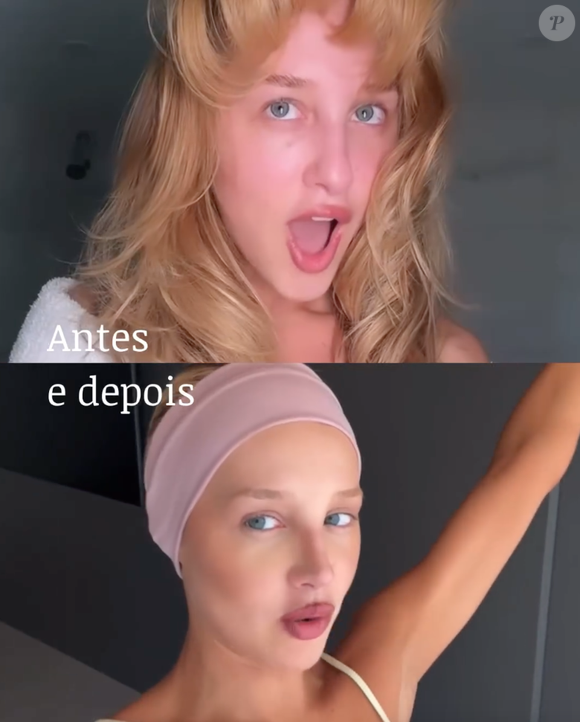 Antes e depois de Malu Borges: veja o resultado da rinoplastia da influenciadora