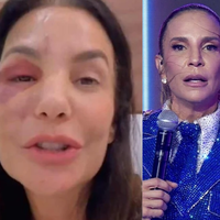 'Ela precisa se recuperar': após fratura no rosto e cirurgia recente, Ivete Sangalo é confirmada no 'BBB 26' e preocupa fãs