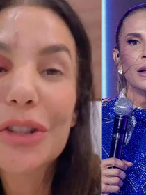 'Ela precisa se recuperar': após fratura no rosto e cirurgia recente, Ivete Sangalo é confirmada no 'BBB 26' e preocupa fãs