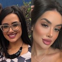 Rinoplastia, botox, harmonização facial... como Jordana, do 'BBB 26', era antes dos procedimentos? 27 fotos mostram que sister ficou irreconhecível com estética