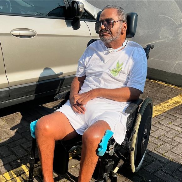 Arlindo Cruz teve um acidente vascular cerebral hemorrágico, ocorrido em março de 2017, após passar mal em casa