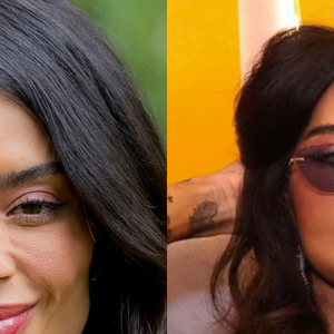 Antes e depois de Aline Campos: veja resultado do lifting facial da atriz