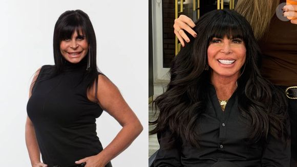 Gretchen também coleciona procedimentos estéticos e um deles é o preenchimento labial, que deixou seus lábios bem mais volumosos