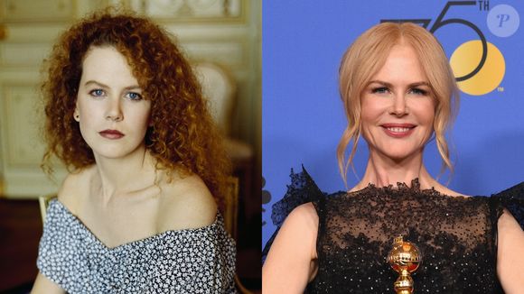 Poucos perceberam, mas Nicole Kidman é mais uma famosa que optou por um preenchimento labial sutil