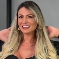 Pronta para beijar muito! Andressa Urach aumenta e define os lábios em novo procedimento estético; veja antes e depois