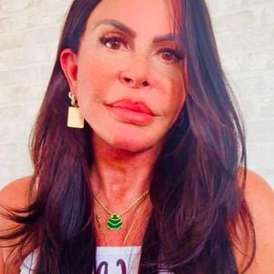 Gretchen passou a apostar na naturalidade sem o exagero de preenchimentos