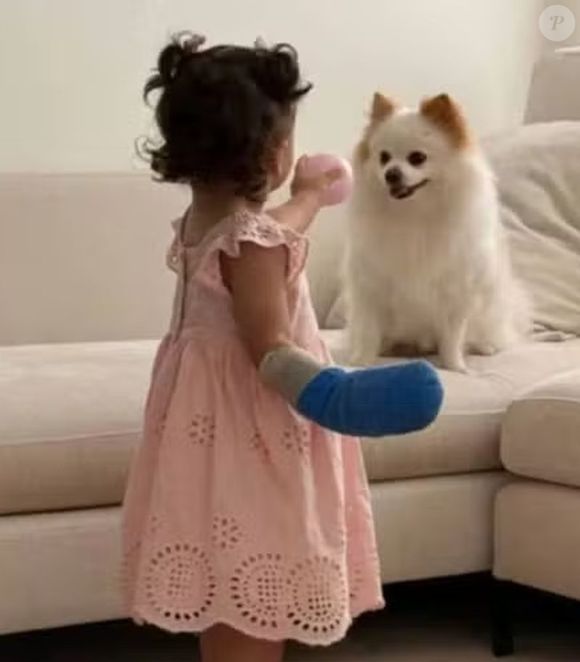 Após a cirurgia, a filha de Amanda Kimberlly e Neymar ficou usando uma tala na mão