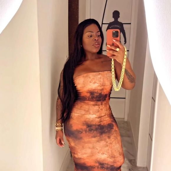 Jojo Todynho perdeu 80 kg desde que realizou uma cirurgia bariátrica há cerca de 1 ano e meio