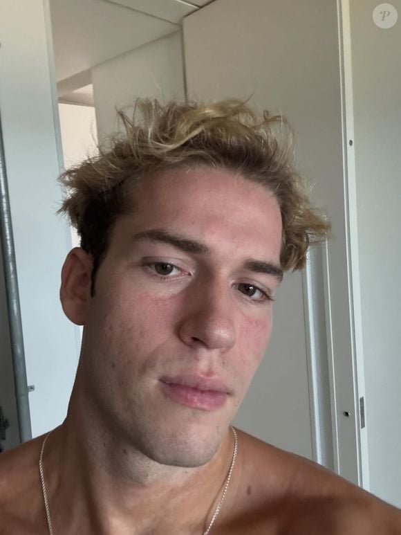 Ator Pietro Antonelli relata que excesso de doce refletiu na pele antes das gravações: 'Tem que passar muita maquiagem no set'