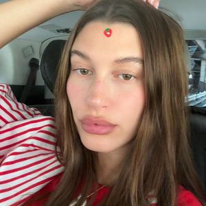 Hailey Bieber revelou, por meio das redes sociais, que sofre com dermatite perioral