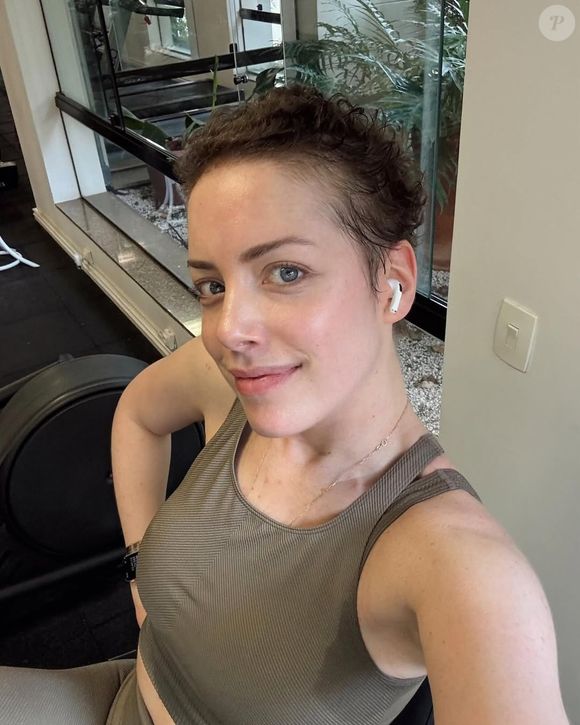 Também conhecida como GVHD, essa é uma complicação comum proveniente do seu transplante de medula óssea, e ela está realizando tratamento com corticoides