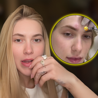 Aposente as dores intensas: o erro de Virgínia após 'espaçar' o tratamento de enxaqueca; entenda por que especialistas recomendam disciplina rigorosa para evitar o efeito rebote