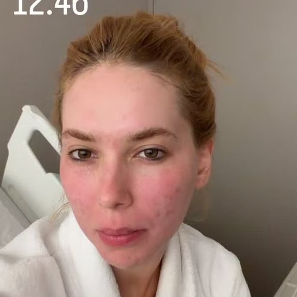 Virgínia, que fez tratamentos para a pele recentemente, tem deixado seu corpo e psicológico preparados para o Carnaval