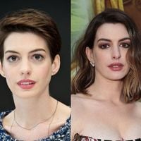 Anne Hathaway antes e depois: da juventude ao suposto lifting facial, 50 fotos mostram transformação impactante da atriz em 26 anos