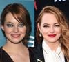 Antes e depois de Emma Stone: essas fotos destacam transformação no rosto da atriz ao longo da carreira