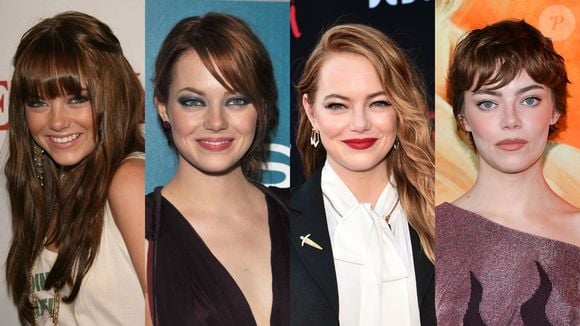 Antes e depois de Emma Stone: essas fotos destacam transformação no rosto da atriz ao longo da carreira