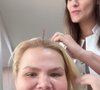 Segundo Thais Carla, sua queda de cabelo acentuou no pós-operatório da bariátrica