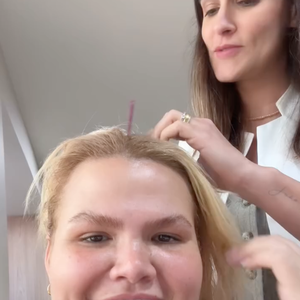 Segundo Thais Carla, sua queda de cabelo acentuou no pós-operatório da bariátrica