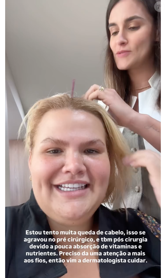 Segundo Thais Carla, sua queda de cabelo acentuou no pós-operatório da bariátrica