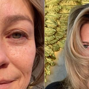 Antes e depois: Luana Piovani é outra famosa adepta da blefaroplastia