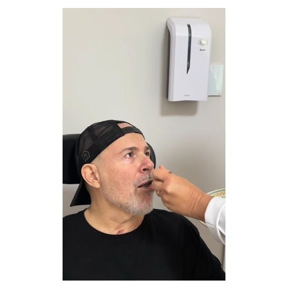 Mingau, do Ultraje a Rigor, se alimenta com comida pastosa dois anos após levar tiro na cabeça