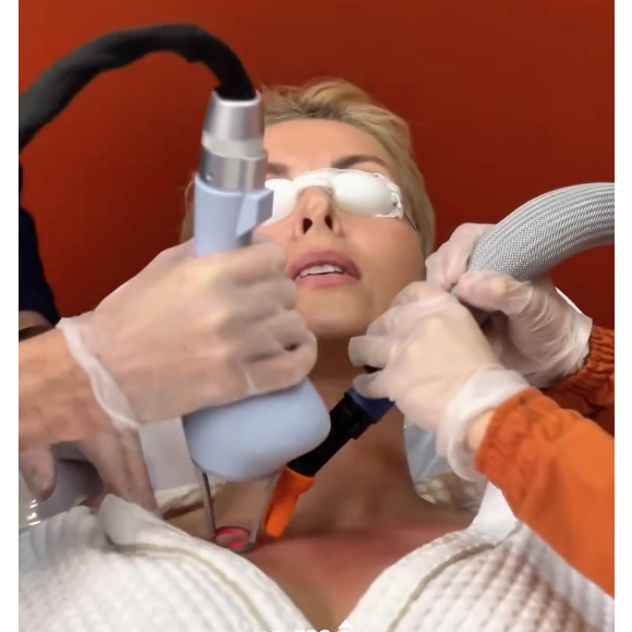 Ana Hickmann também realizou o procedimento antes do seu tão comentado casamento com Edu Guedes, e aprovou o resultado