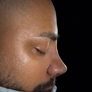 Veja foto do 'depois' do sósia de Neymar após rinoplastia